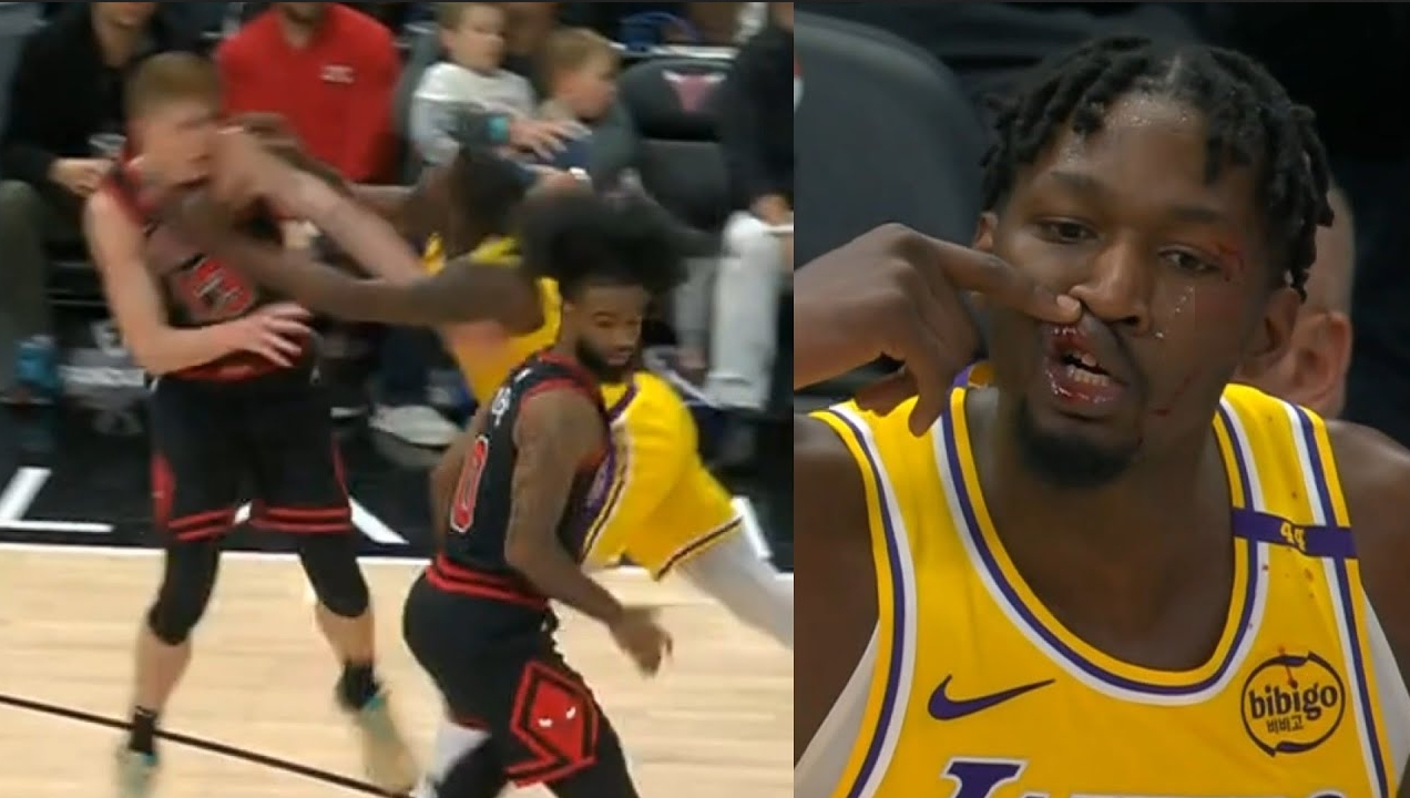 NBA / 【影片】湖人公牛爆發衝突！芬尼-史密斯遭肘擊眉骨出血，怒推對手後離場治療！