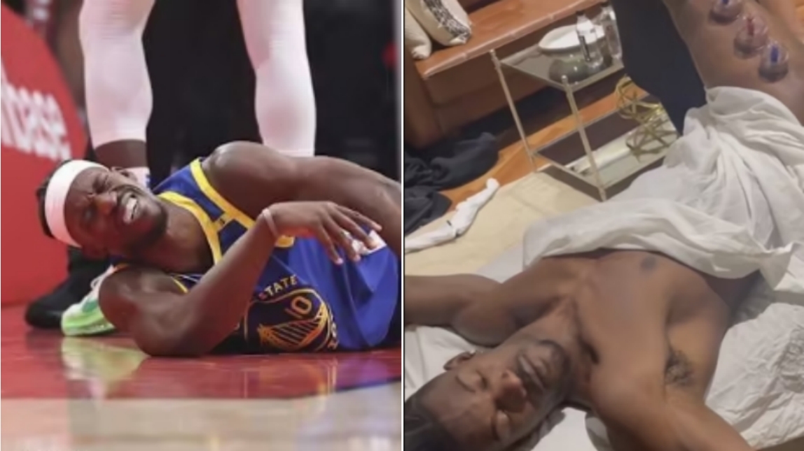NBA / 巴特勒接受拔罐治療！勇士官方更新傷情，科爾透露他仍有可能出戰G3